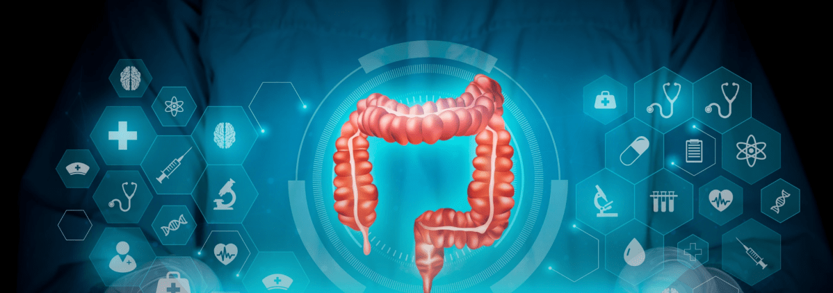 More Evidence that Molecular Residual Disease Monitoring Could Guide Adjuvant Therapy in Colorectal&nbsp;Cancer
