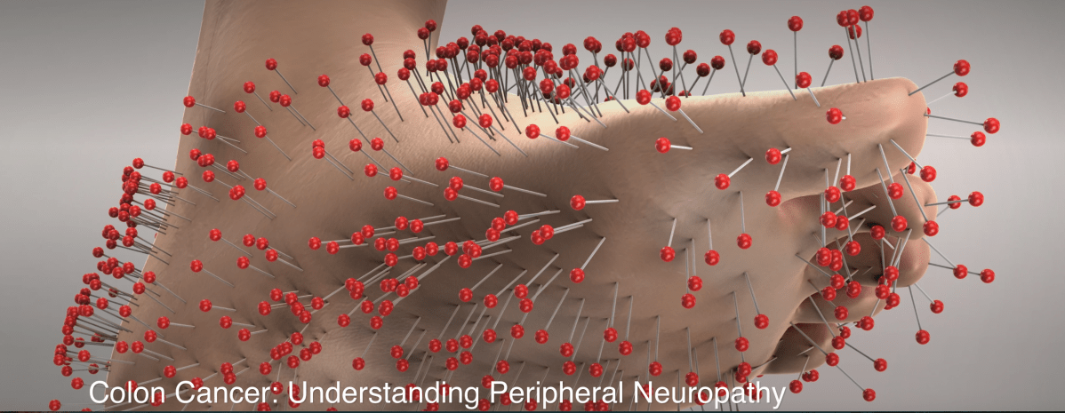What Is Peripheral&nbsp;Neuropathy?